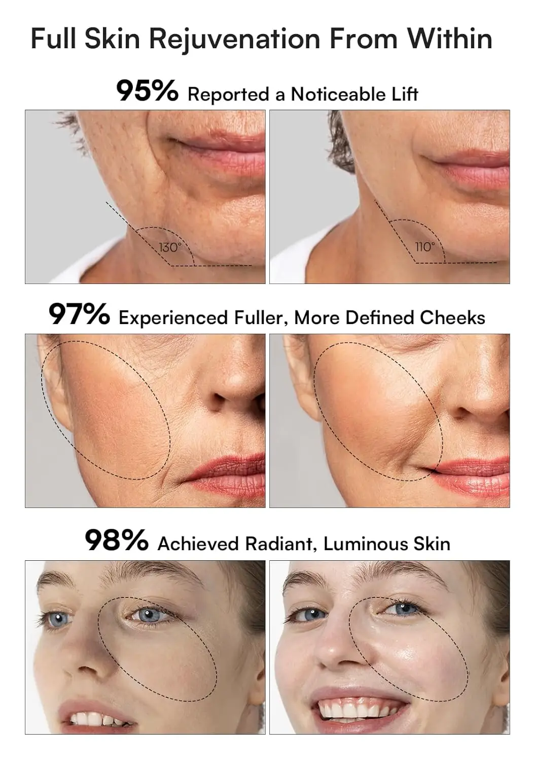 INIA 3-in-1 Skin Tightening Device texture