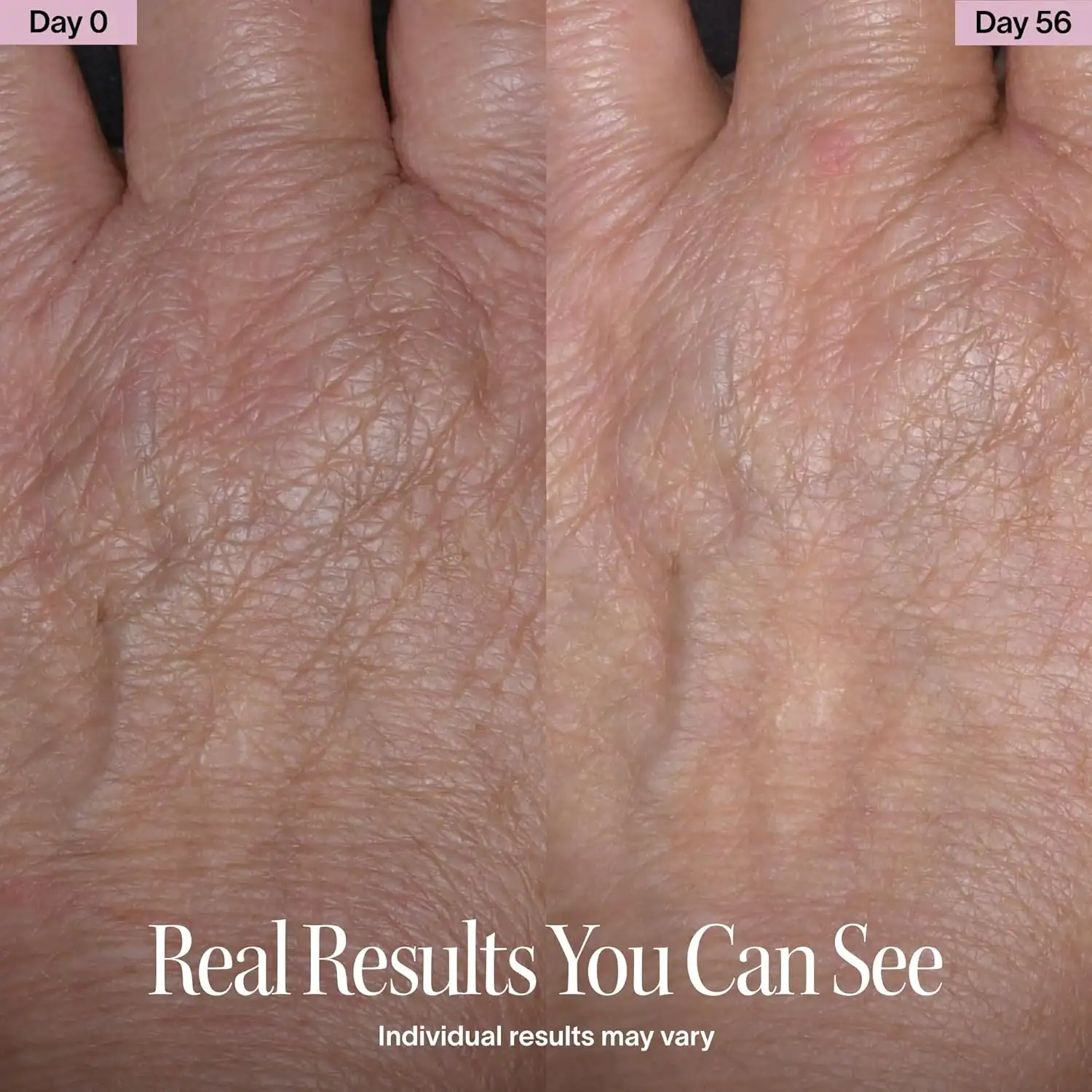 Solawave Red Light Therapy Device for Face & Body detail