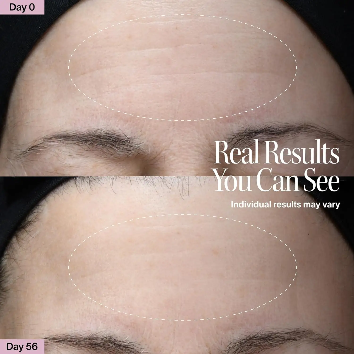 Solawave Red Light Therapy Device for Face & Body showcase