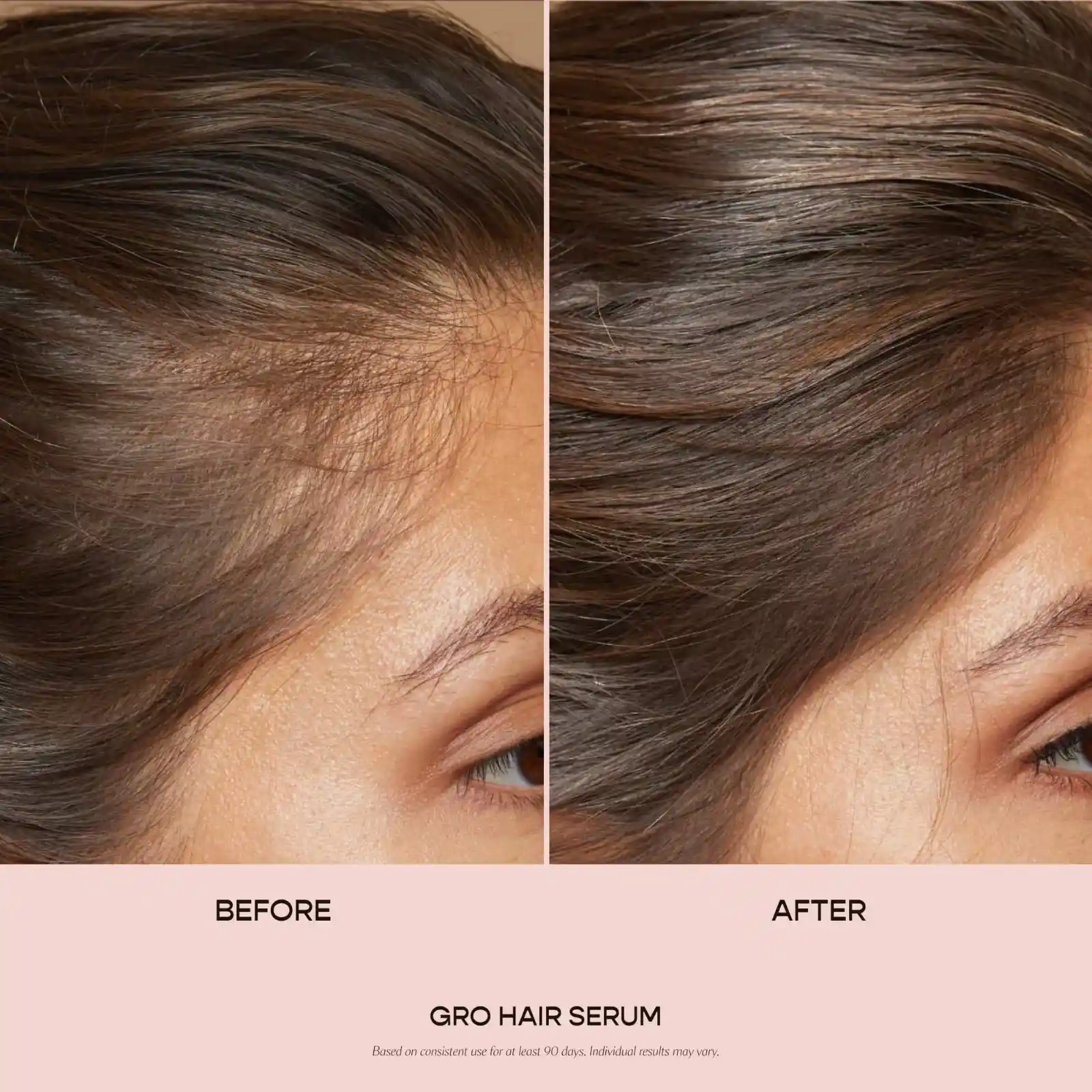 VEGAMOUR GRO Hair Serum for Hair Thinning & Shedding detail