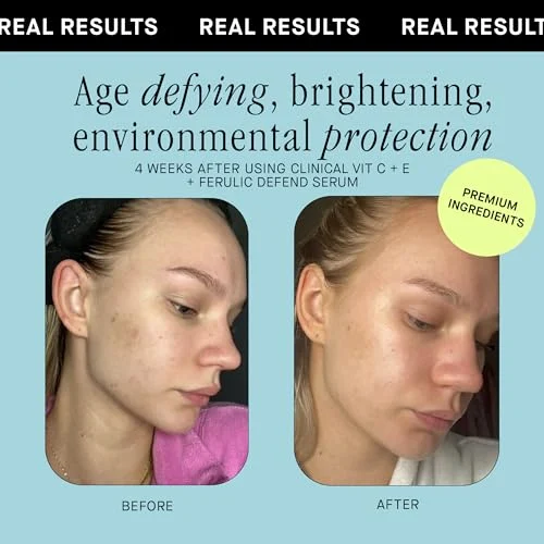 Brandefy Vitamin C Face Serum – Brightening Dark Spot Corrector unboxing