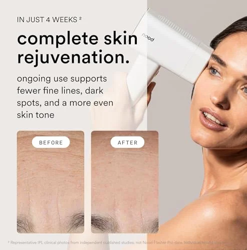 Nood Flasher Pro – Pain-Free IPL Hair Removal Device for Home Use detail
