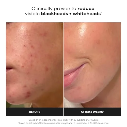 Paula’s Choice 2% BHA Liquid Exfoliant – Smooths Pores & Fine Lines detail