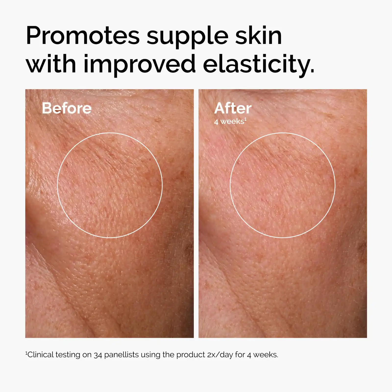 The Ordinary Serum Favorites Set – Hyaluronic Acid 2% + B5 showcase