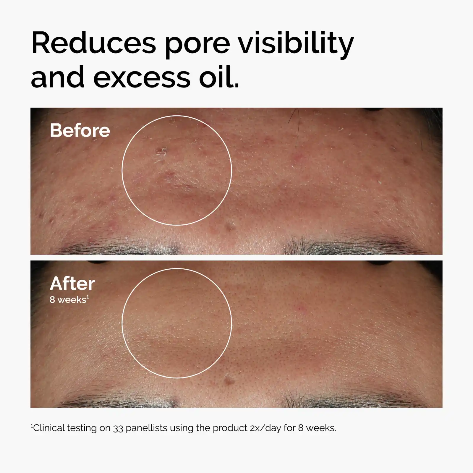 The Ordinary Serum Favorites Set – Hyaluronic Acid 2% + B5 unboxing