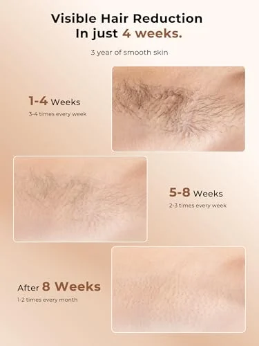 Ubroo Hand-held Laser Hair Removal – IPL Device with Ice Cooling features