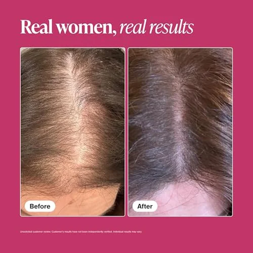Viviscal Hair Growth Supplements – Support Thicker Hair for Women unboxing